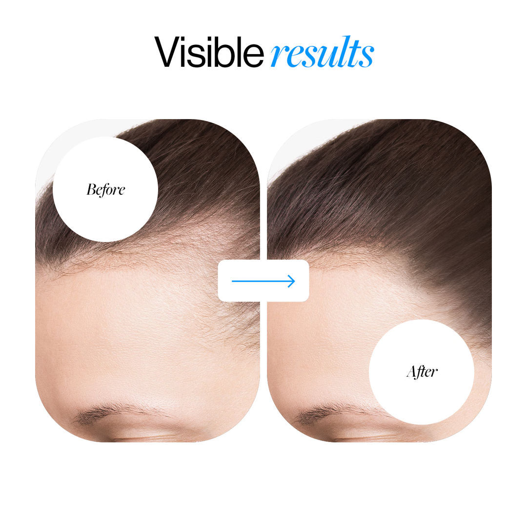 Bodywise Rosemary Hair Care Essence Roll-On